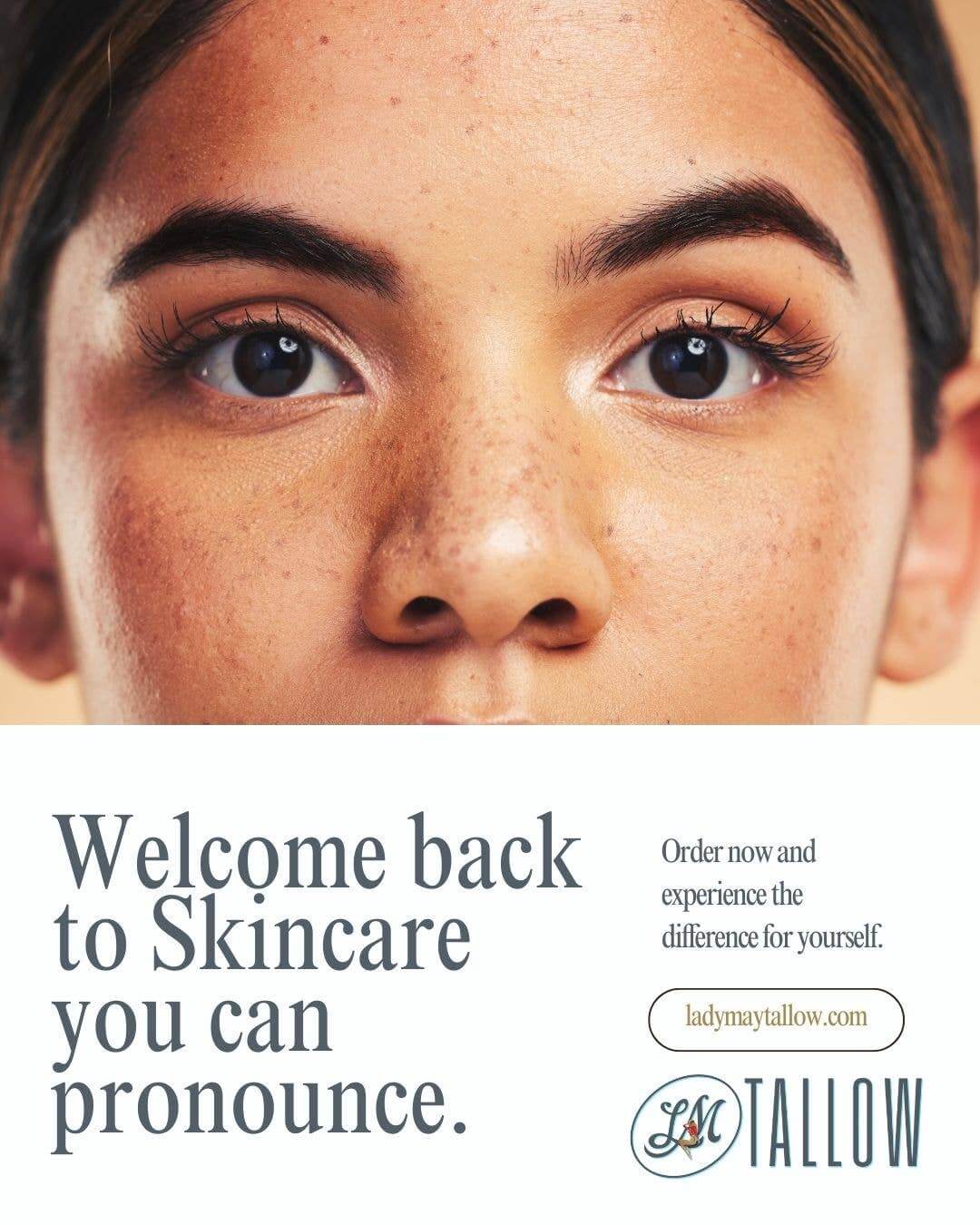 Unscented Whipped Tallow Moisturizer | 100% Natural Skincare: 9oz Lady May Tallow